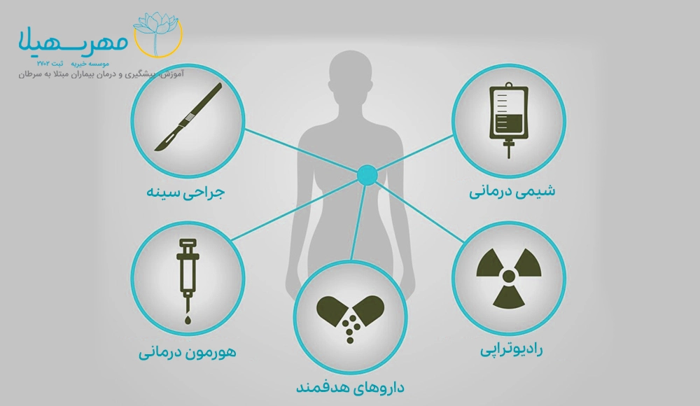 Breast Cancer MSb درمان سرطان سینه