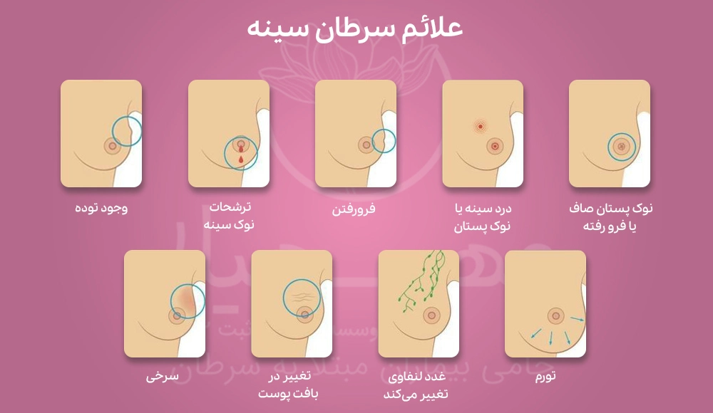 Breast Cancer MSb علائم سرطان سینه