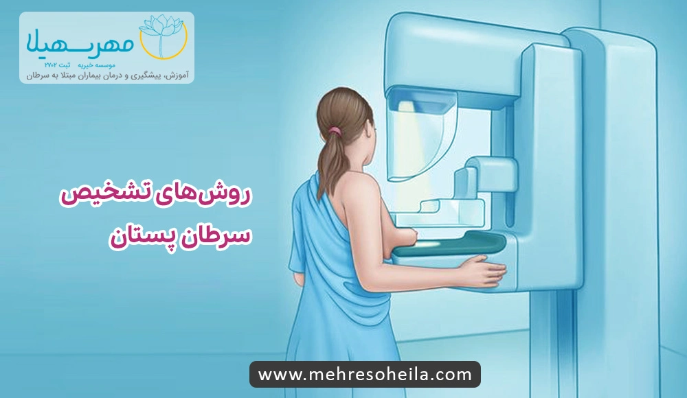 Breast Cancer MSb تشخیص سرطان پستان