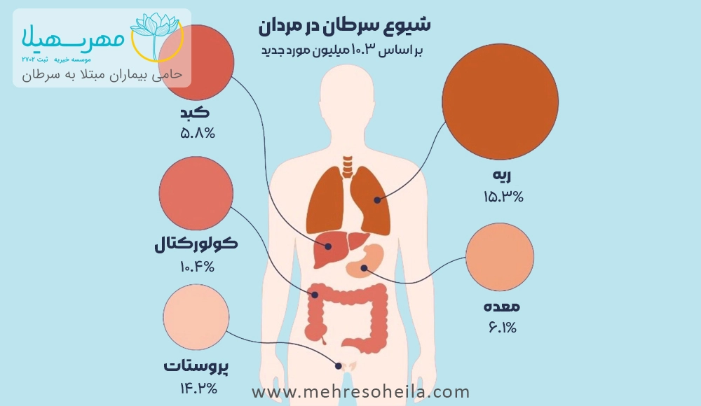 Cancer Prevalence In Men آمار شایع ترین سرطان مردان در ایران و جهان