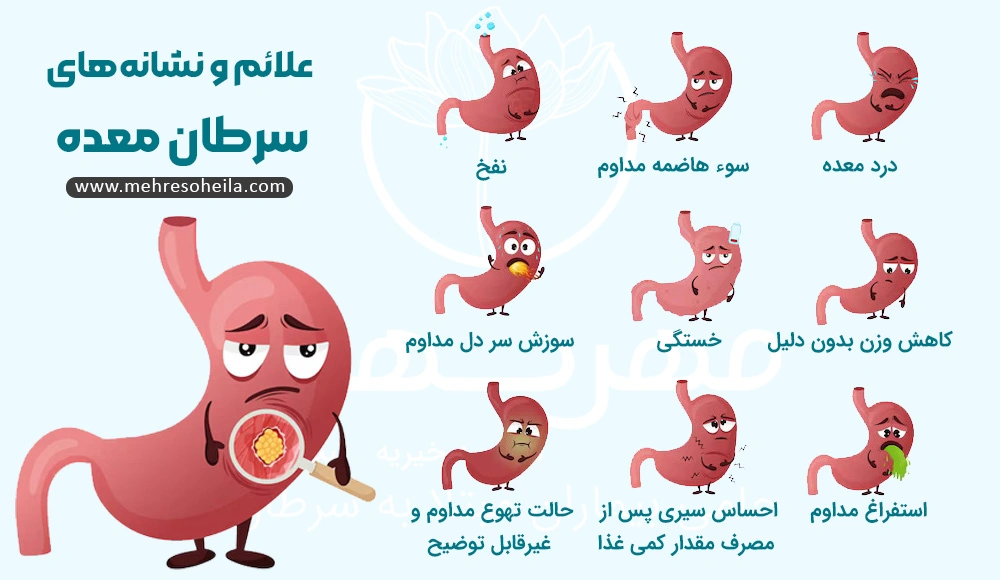 Stomach Cancer MS علائم و نشانههای سرطان معده