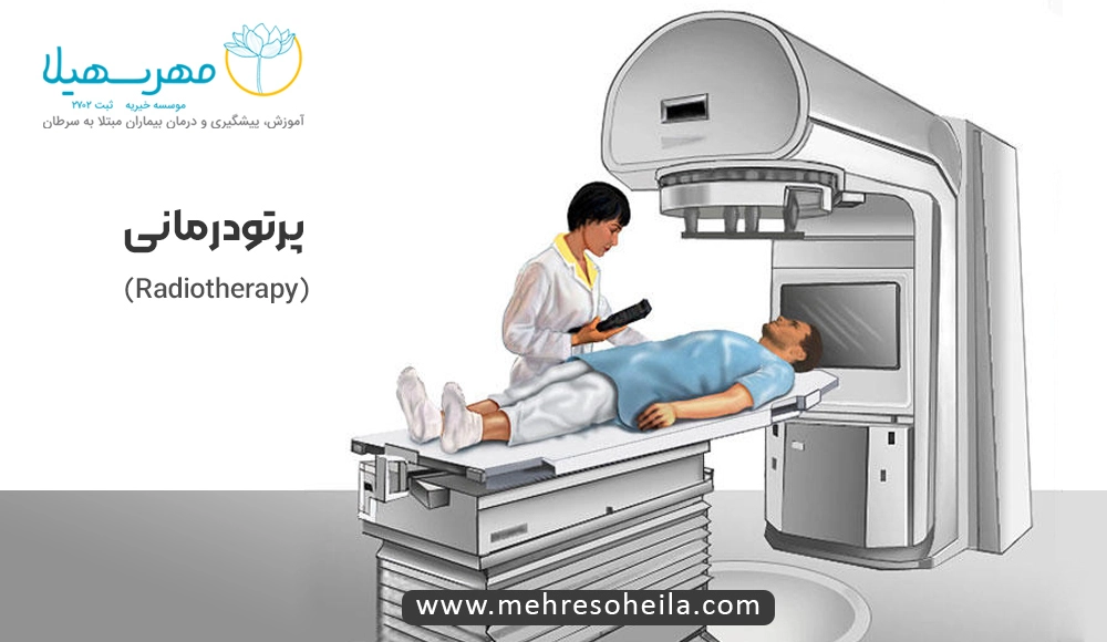 Stomach Cancer MS پرتودرمانی سرطان معده