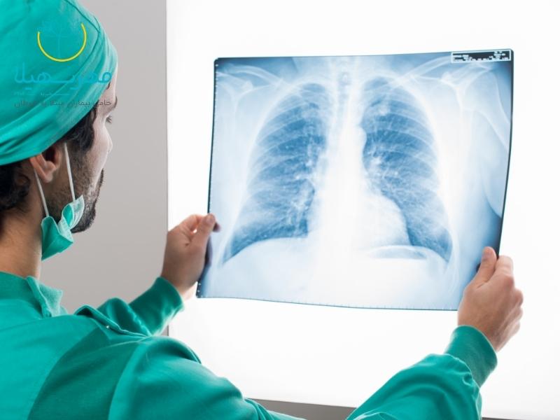برای تشخیص سرطان ریه چه باید کرد؟