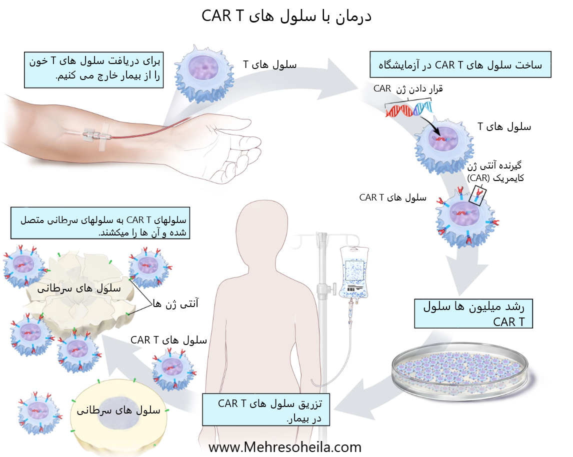 سلولهای CAR T