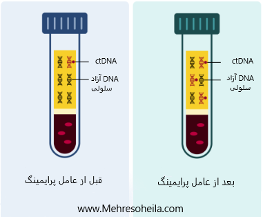 تشخیص دقیق بیوپسی مایع با ctDNA